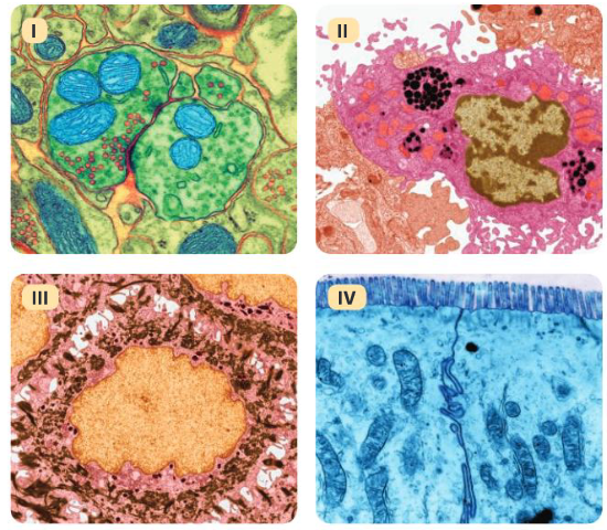 IB MYP Biology : Cells - tissues Practice Question