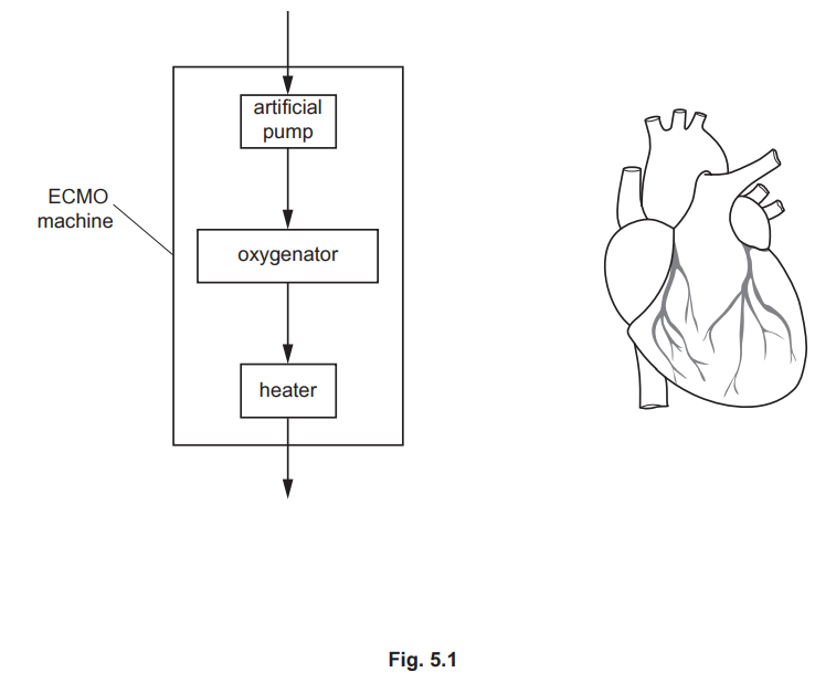ECMO Machine Diagram
