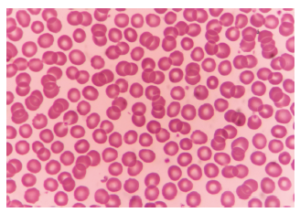 Human red blood cells