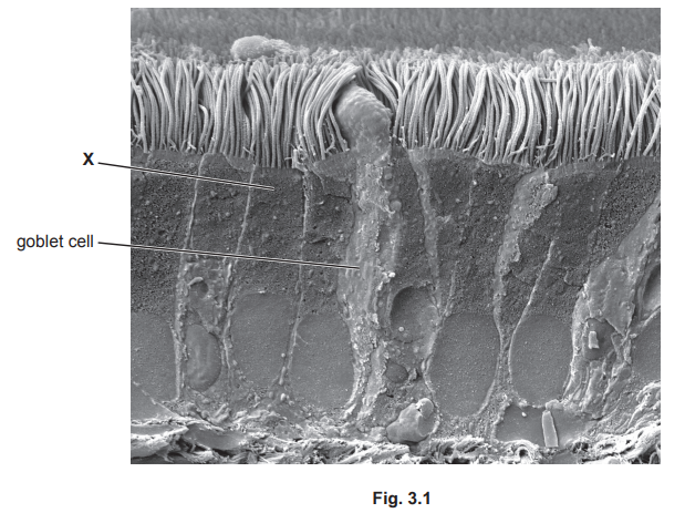 Trachea cells