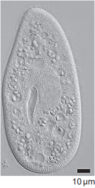 Paramecium with food vacuoles